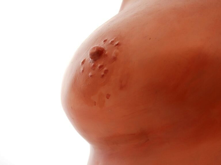 Plester Silikon Untuk Parut Pembedahan: Pilihan Terbaik Untuk Gaya Hidup Aktif dan Modern Anda